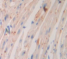 Polyclonal Antibody to Adenylate Cyclase 9 (ADCY9)