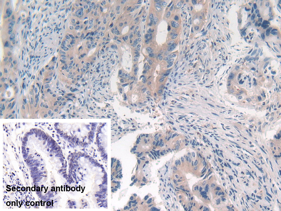 Polyclonal Antibody to Mitogen Activated Protein Kinase 7 (MAPK7)