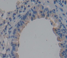 Polyclonal Antibody to Immunoglobulin Superfamily, Member 2 (IGSF2)