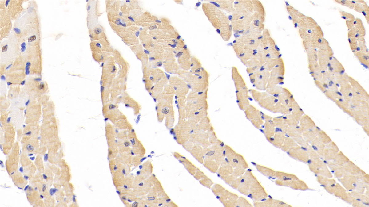 Polyclonal Antibody to Enolase 3 (ENO3)