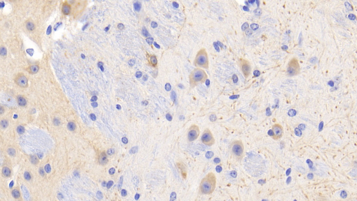 Polyclonal Antibody to Proteinase 3 (PR3)