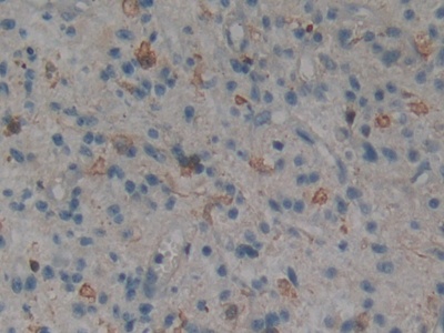 Polyclonal Antibody to Mitogen Activated Protein Kinase 11 (MAPK11)