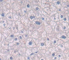 Polyclonal Antibody to Integrin Beta 4 (ITGb4)