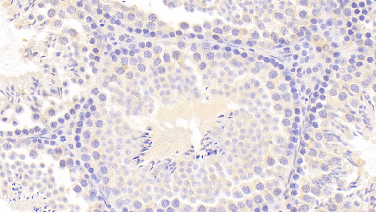 Polyclonal Antibody to Ribonuclease Inhibitor (RI)