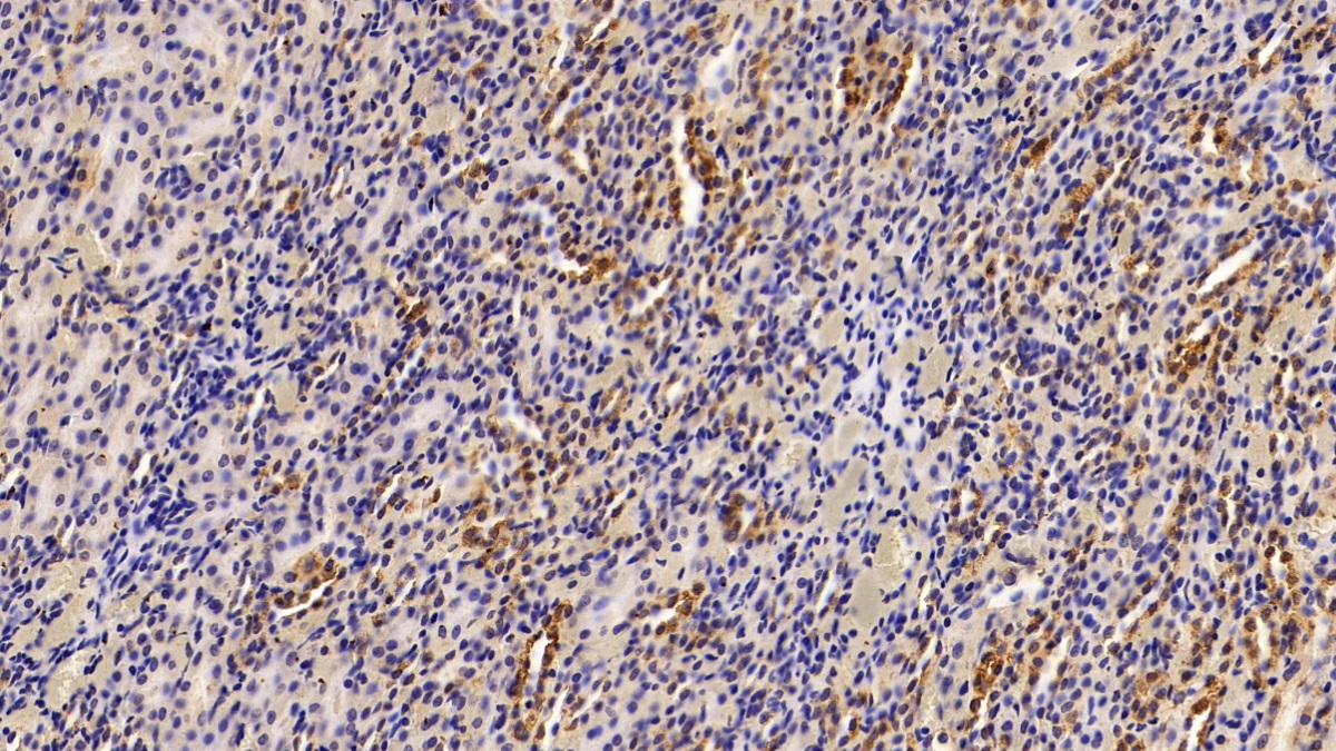 Polyclonal Antibody to Enolase 1 (ENO1)