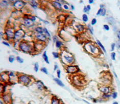 Polyclonal Antibody to Connexin 31 (CX31)