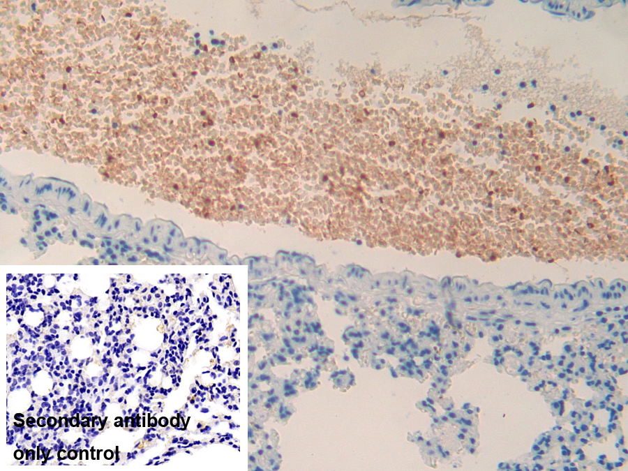 Polyclonal Antibody to Thrombopoietin Receptor (TPOR)