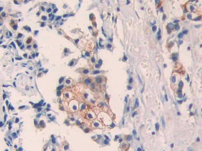 Polyclonal Antibody to Pitrilysin Metalloproteinase 1 (MP1)