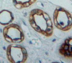 Polyclonal Antibody to Nectin 2 (NECTIN2)