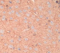 Polyclonal Antibody to Matrix Gla Protein (MGP)