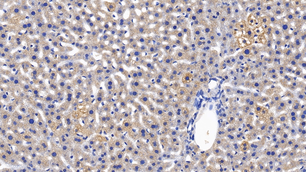 Polyclonal Antibody to Mannose Binding Lectin (MBL)