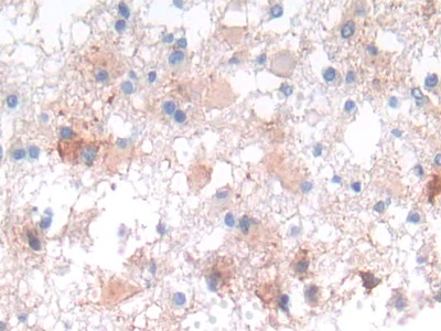 Polyclonal Antibody to N-cadherin (NCAD)