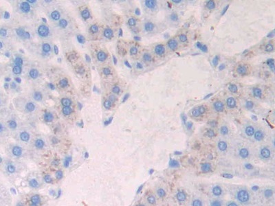 Polyclonal Antibody to N-cadherin (NCAD)