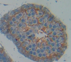 Polyclonal Antibody to N-cadherin (NCAD)