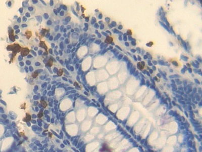 Polyclonal Antibody to Ornithine Transcarbamylase (OTC)