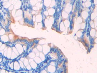 Polyclonal Antibody to Ornithine Transcarbamylase (OTC)