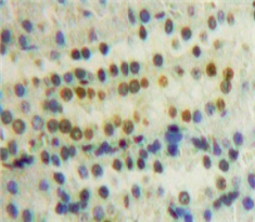 Polyclonal Antibody to Peptidylprolyl Isomerase E (PPIE)