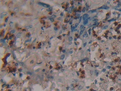 Polyclonal Antibody to Fibromodulin (FMOD)