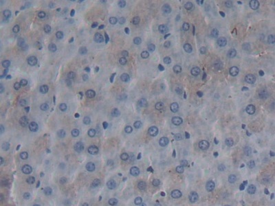 Polyclonal Antibody to Fibromodulin (FMOD)