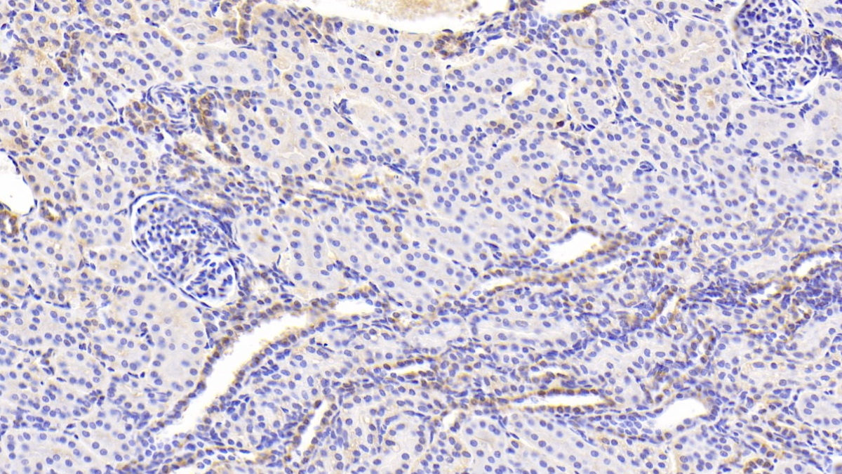 Polyclonal Antibody to Endoplasmic Reticulum Resident Protein 57 (ERp57)