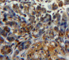 Polyclonal Antibody to Protein Disulfide Isomerase (PDI)