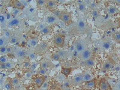 Polyclonal Antibody to Tumor Necrosis Factor Receptor 1 (TNFR1)