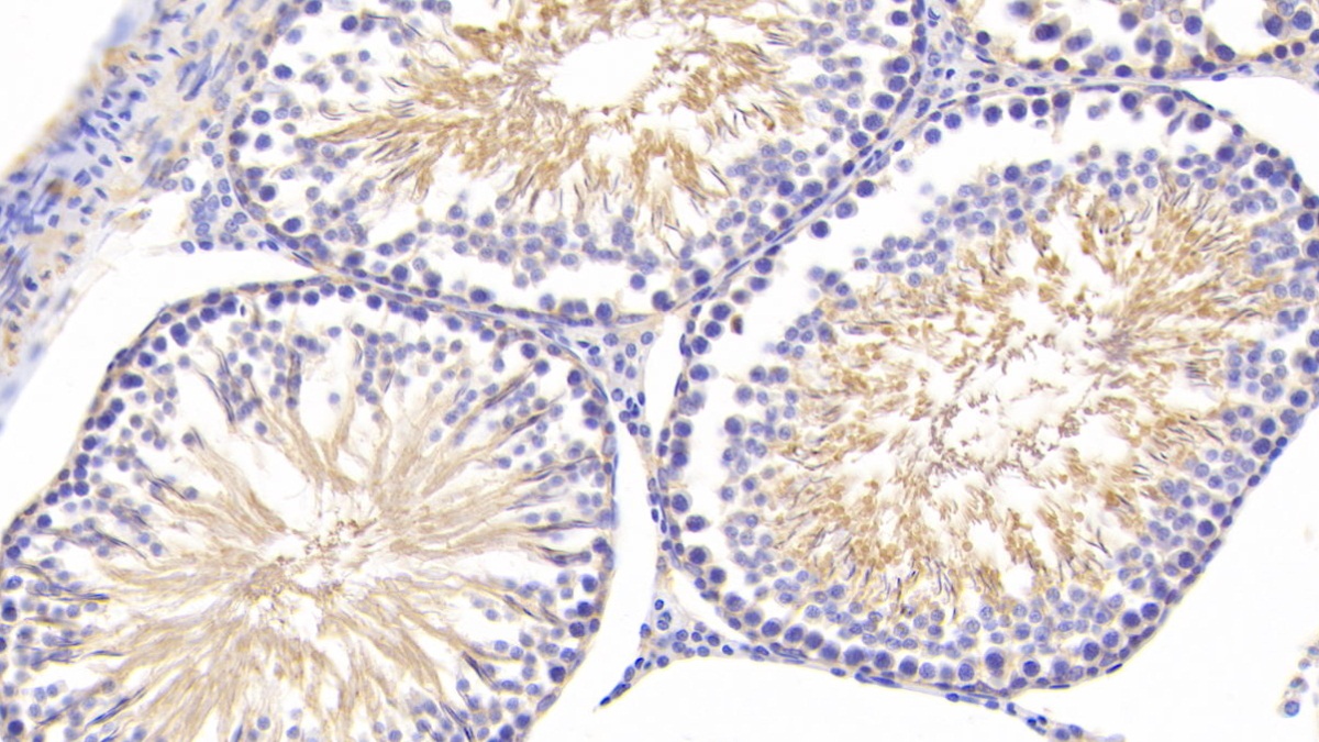 Polyclonal Antibody to Tumor Necrosis Factor Receptor 1 (TNFR1)