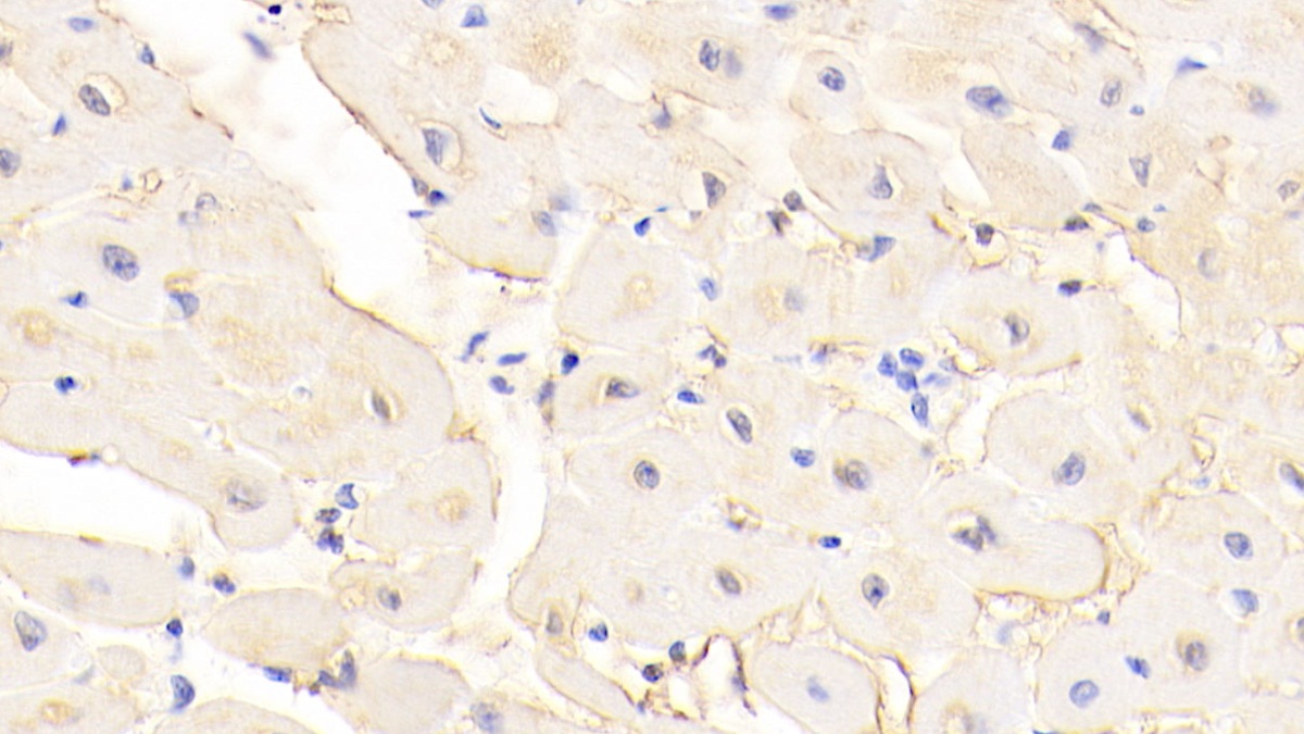 Polyclonal Antibody to Dystrophin (DMD)