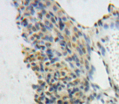 Polyclonal Antibody to General Transcription Factor IIE, Polypeptide 1 (GTF2E1)