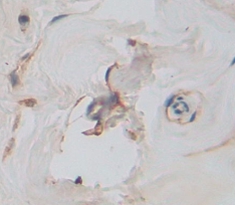 Polyclonal Antibody to Killer Cell Immunoglobulin Like Receptor 2DL1 (KIR2DL1)