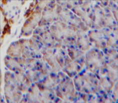 Polyclonal Antibody to Interleukin 9 Receptor (IL9R)