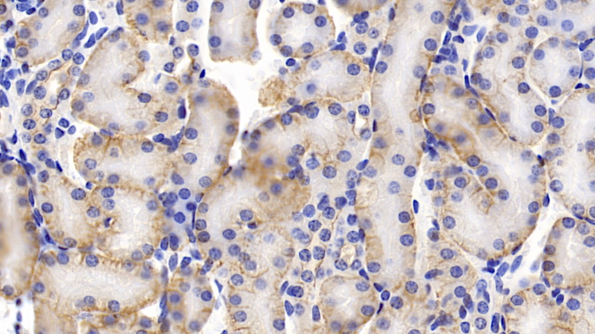 Polyclonal Antibody to Prominin 1 (PROM1)