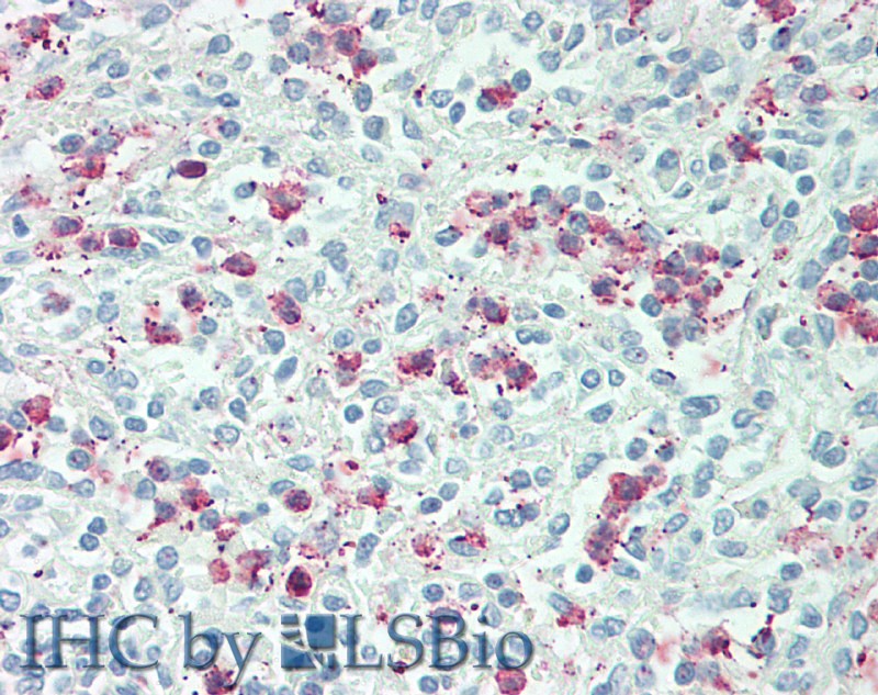 Polyclonal Antibody to Tumor Necrosis Factor Receptor Superfamily, Member 4 (TNFRSF4)