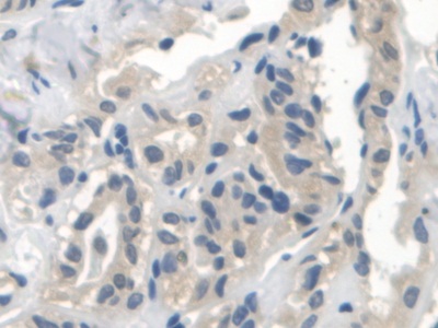 Polyclonal Antibody to Neuronal Apoptosis Inhibitory Protein (NAIP)