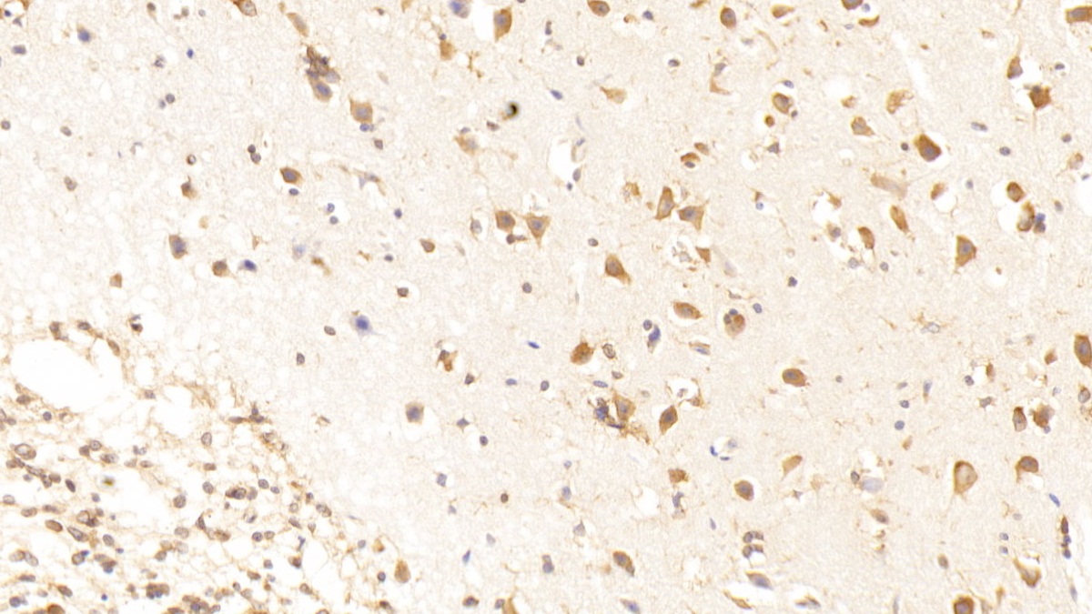 Polyclonal Antibody to Macrophage Stimulating 1 Receptor (MST1R)