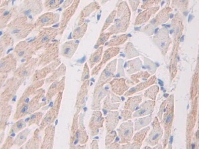 Polyclonal Antibody to Macrophage Stimulating 1 Receptor (MST1R)