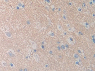 Polyclonal Antibody to Probable ATP-dependent RNA Helicase DDX58 (DDX58)