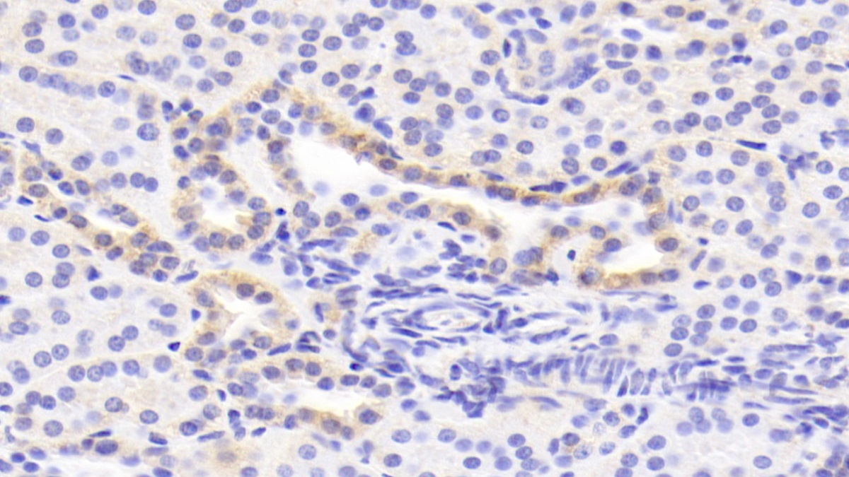 Polyclonal Antibody to Chemokine C-C-Motif Receptor 1 (CCR1)