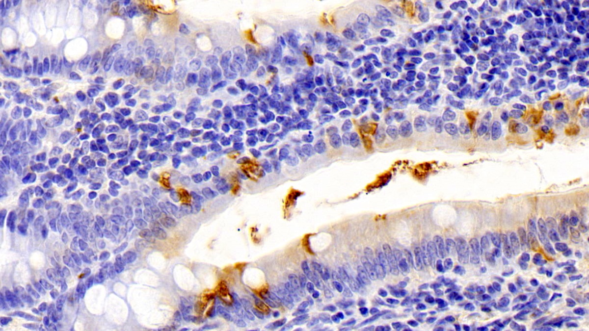 Polyclonal Antibody to Protease, Serine 2 (PRSS2)