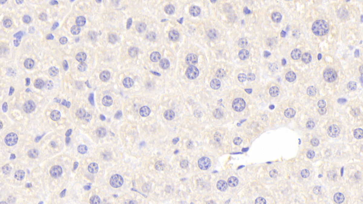 Polyclonal Antibody to Gamma-cystathionase (CTH)