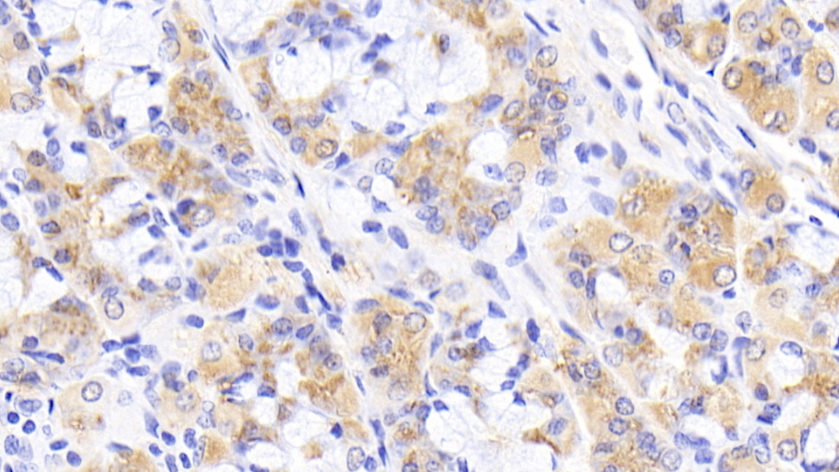 Polyclonal Antibody to Serum Amyloid P Component (SAP)