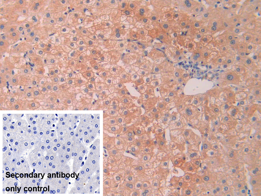 Polyclonal Antibody to Serum Amyloid P Component (SAP)