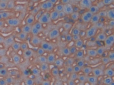 Polyclonal Antibody to Cluster Of Differentiation 147 (CD147)