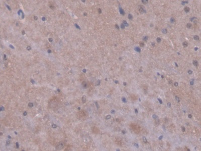 Polyclonal Antibody to Peptidylprolyl Isomerase F (PPIF)