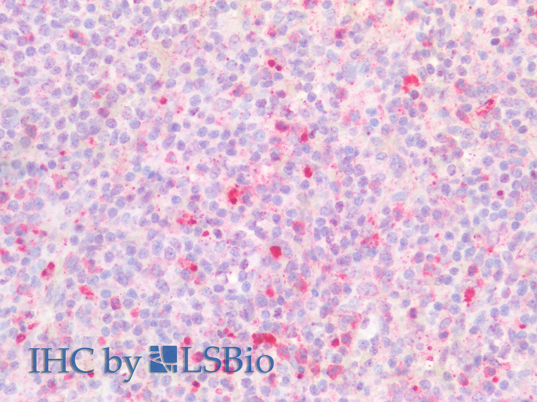 Polyclonal Antibody to Bone Marrow Stromal Cell Antigen 1 (BST1)