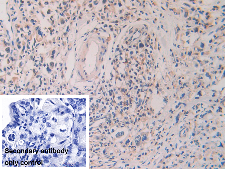 Polyclonal Antibody to Z-DNA Binding Protein 1 (ZBP1)