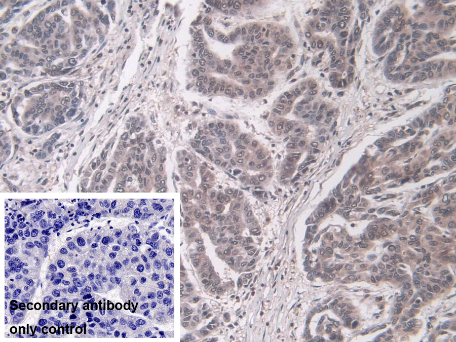 Polyclonal Antibody to Large Multifunctional Peptidase 7 (LMP7)