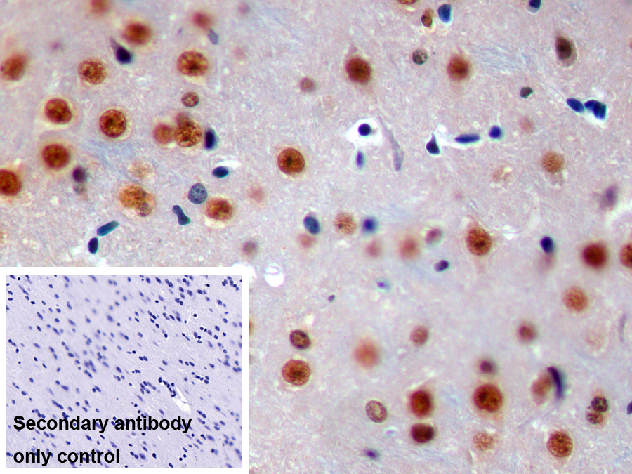 Polyclonal Antibody to Interferon Regulatory Factor 1 (IRF1)