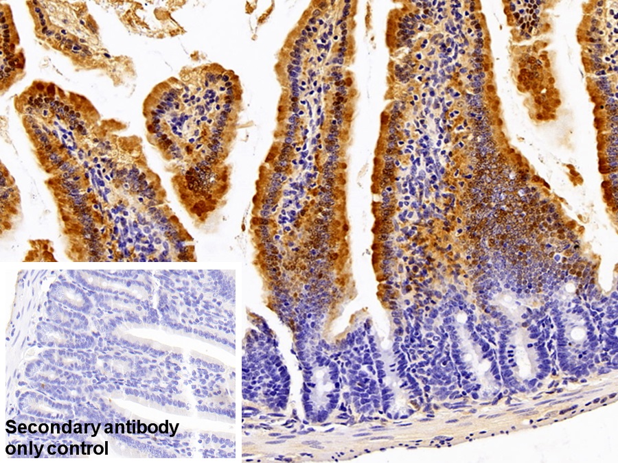 Polyclonal Antibody to Fatty Acid Binding Protein 1 (FABP1)