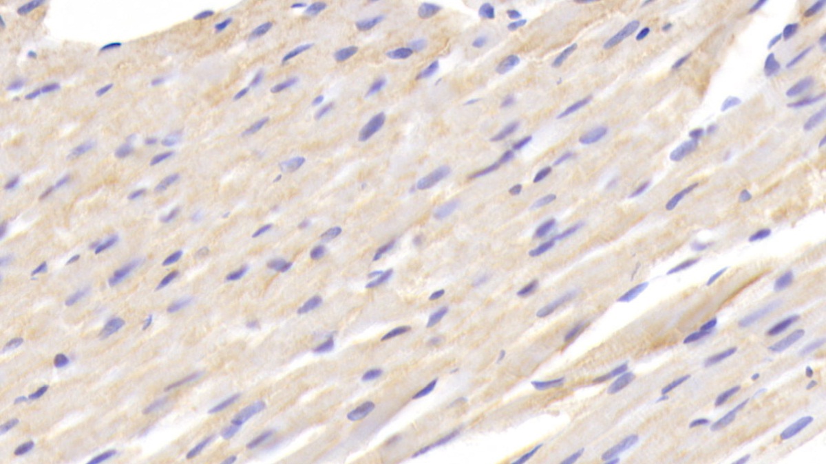 Polyclonal Antibody to Fatty Acid Binding Protein 1 (FABP1)